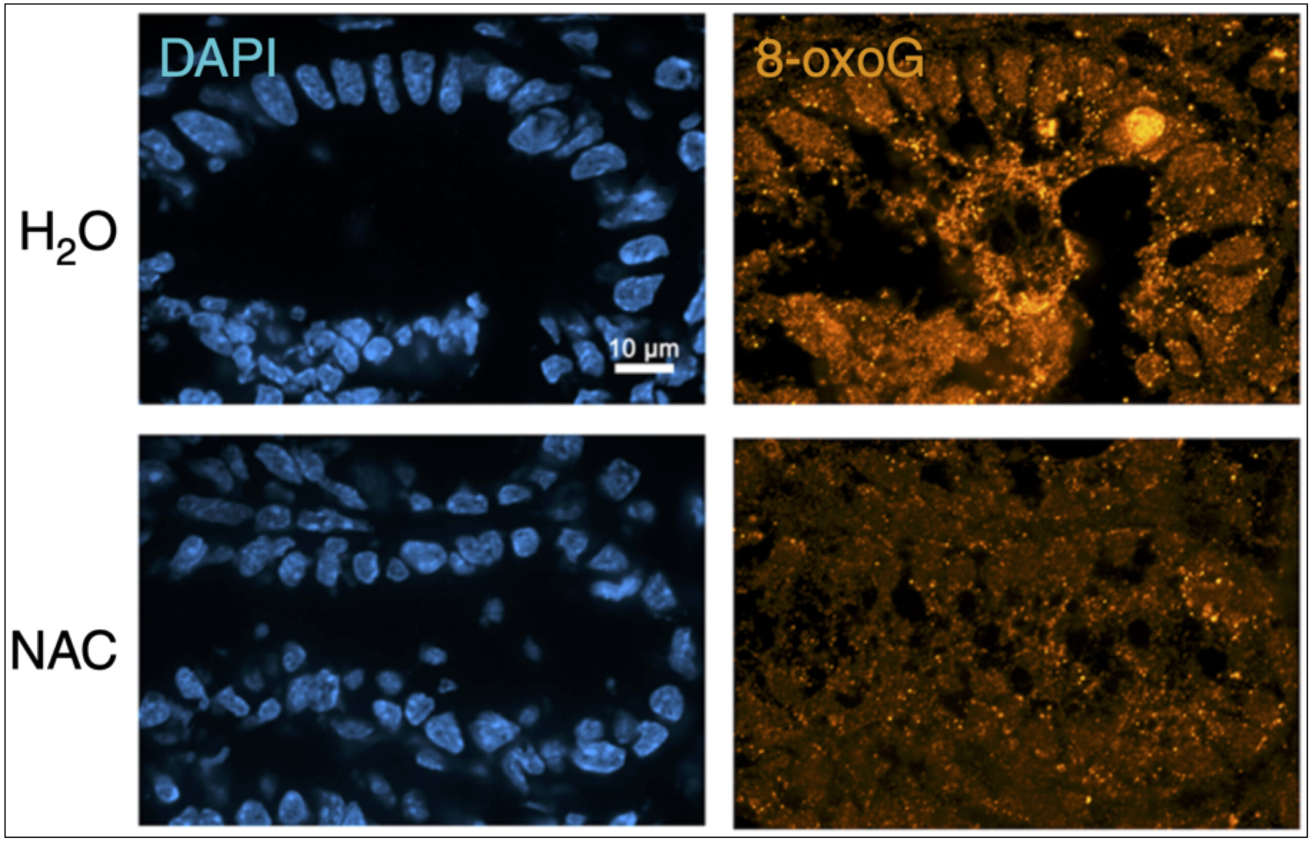 Read more about the article Using Antioxidants to Treat Bacterial-Induced Colorectal Cancer